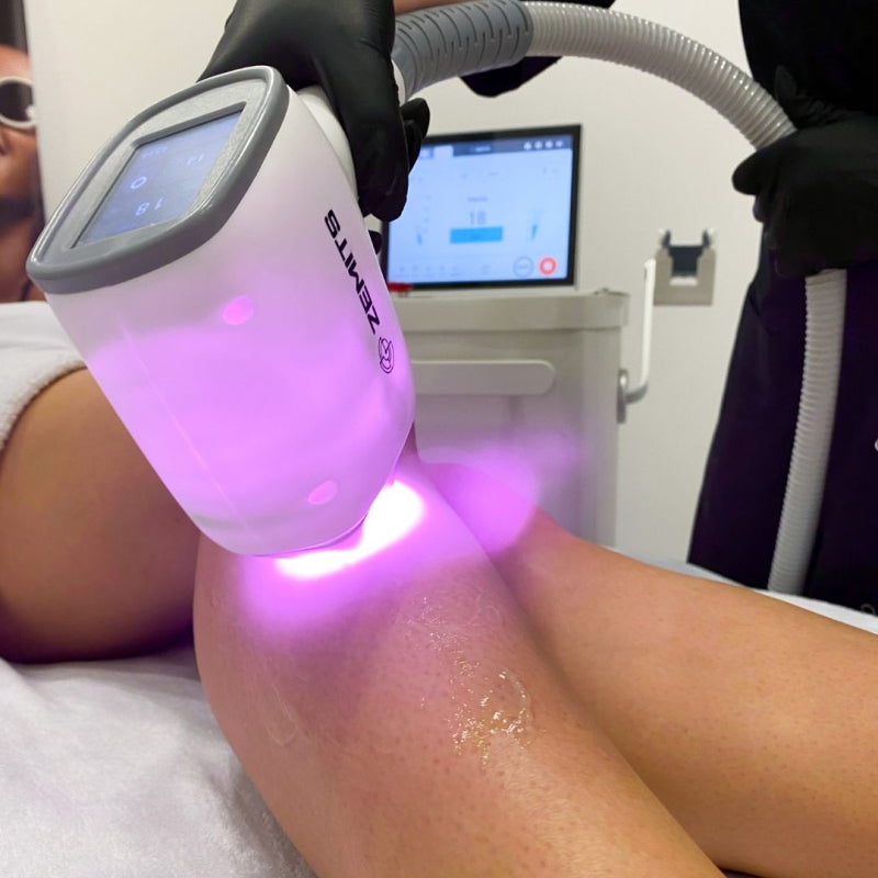 Zemits Quidion Diode Laser For Hair Removal